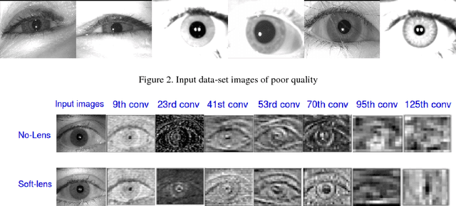Figure 4 for GHCLNet: A Generalized Hierarchically tuned Contact Lens detection Network