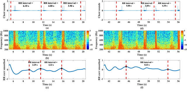 Figure 3 for Remote Monitoring of Patient Respiration with Mask Attachment -- A Pragmatic Solution for Medical Facilities