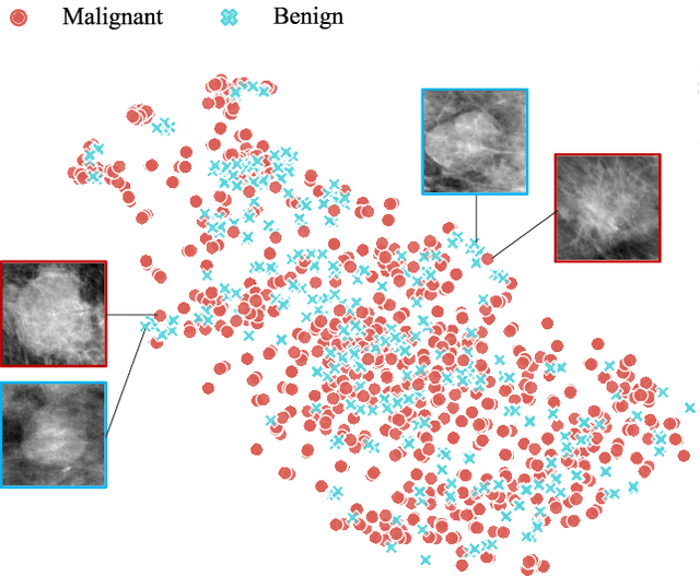 Figure 1 for COIN: Contrastive Identifier Network for Breast Mass Diagnosis in Mammography
