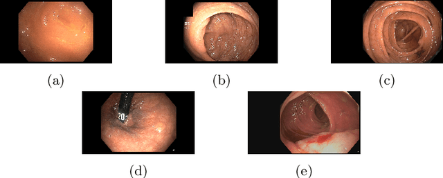 Figure 2 for Colonoscopy Landmark Detection using Vision Transformers