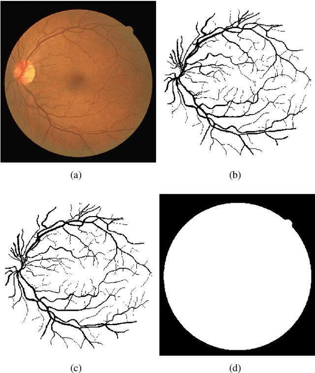 Figure 1 for A new baseline for retinal vessel segmentation: Numerical identification and correction of methodological inconsistencies affecting 100+ papers