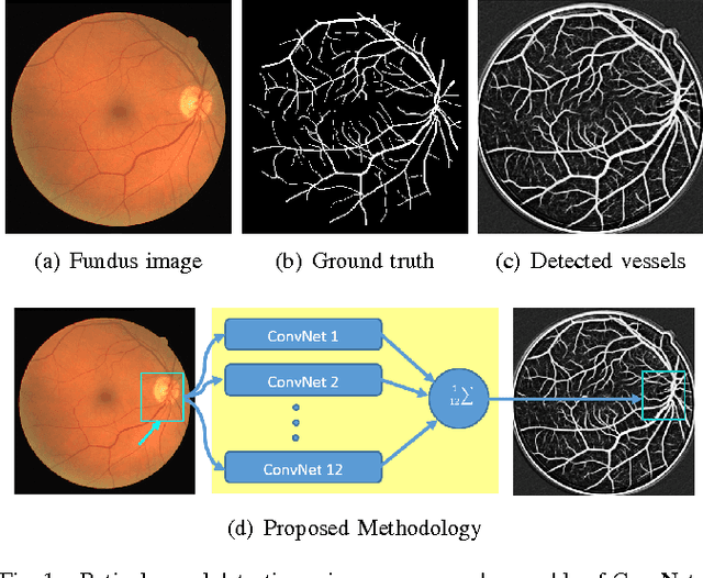 Figure 1 for Ensemble of Deep Convolutional Neural Networks for Learning to Detect Retinal Vessels in Fundus Images