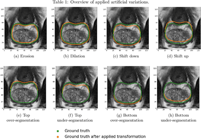 Figure 3 for Observer variation-aware medical image segmentation by combining deep learning and surrogate-assisted genetic algorithms