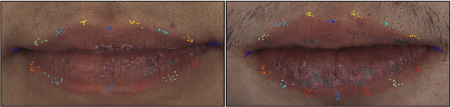 Figure 1 for Supervision by Registration and Triangulation for Landmark Detection