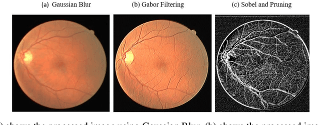 Figure 1 for A Trio-Method for Retinal Vessel Segmentation using Image Processing