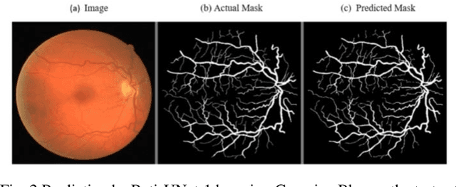 Figure 3 for A Trio-Method for Retinal Vessel Segmentation using Image Processing