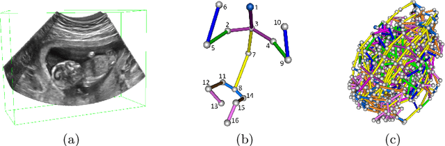 Figure 1 for FetusMap: Fetal Pose Estimation in 3D Ultrasound