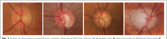 Figure 1 for Two-stage framework for optic disc localization and glaucoma classification in retinal fundus images using deep learning