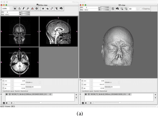 Figure 1 for DeepDefacer: Automatic Removal of Facial Features via U-Net Image Segmentation