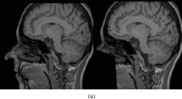 Figure 3 for DeepDefacer: Automatic Removal of Facial Features via U-Net Image Segmentation