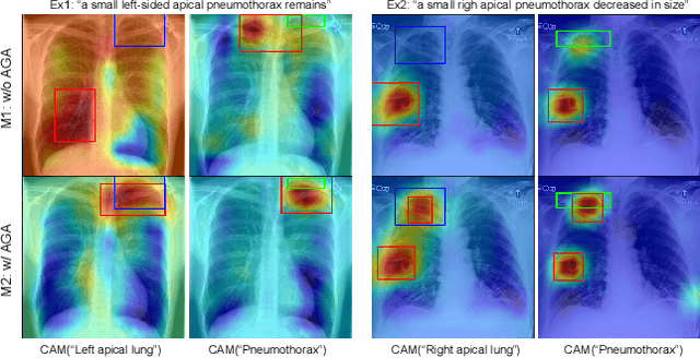 Figure 4 for Anatomy-Guided Weakly-Supervised Abnormality Localization in Chest X-rays