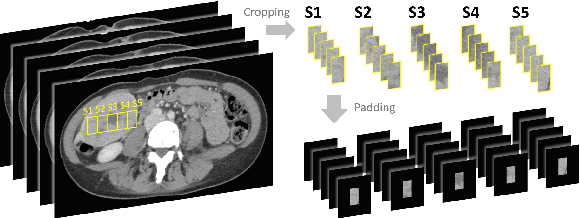 Figure 4 for Multi-Phase Cross-modal Learning for Noninvasive Gene Mutation Prediction in Hepatocellular Carcinoma