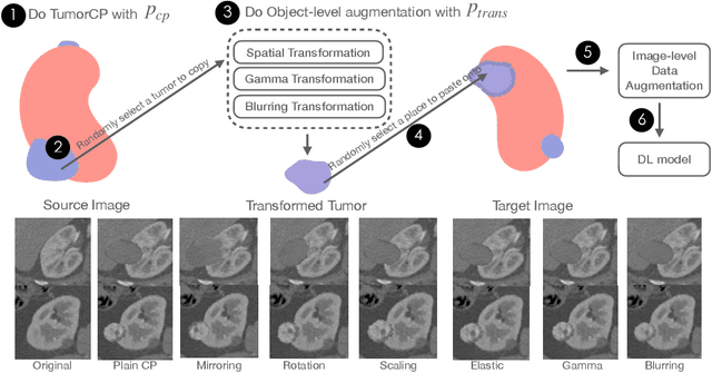 Figure 1 for TumorCP: A Simple but Effective Object-Level Data Augmentation for Tumor Segmentation