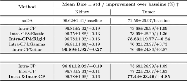 Figure 2 for TumorCP: A Simple but Effective Object-Level Data Augmentation for Tumor Segmentation