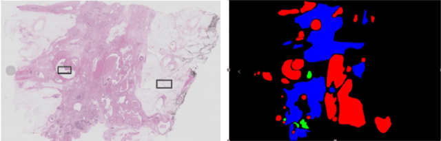 Figure 1 for DA-RefineNet:A Dual Input Whole Slide Image Segmentation Algorithm Based on Attention