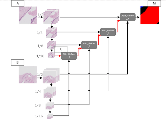 Figure 2 for CA-RefineNet:A Dual Input WSI Image Segmentation Algorithm Based on Attention
