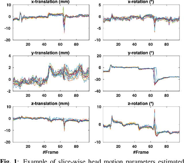 Figure 1 for 4D iterative reconstruction of brain fMRI in the moving fetus