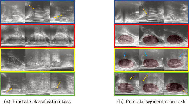 Figure 4 for Adaptable image quality assessment using meta-reinforcement learning of task amenability