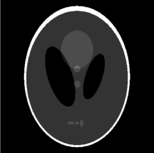 Figure 1 for TorchRadon: Fast Differentiable Routines for Computed Tomography