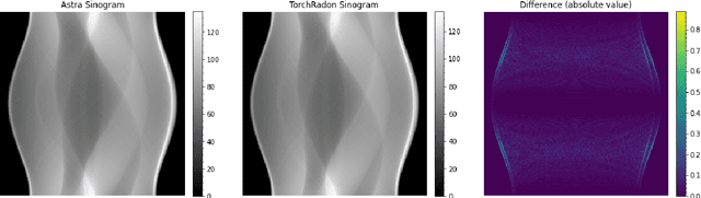 Figure 3 for TorchRadon: Fast Differentiable Routines for Computed Tomography