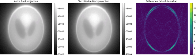 Figure 4 for TorchRadon: Fast Differentiable Routines for Computed Tomography