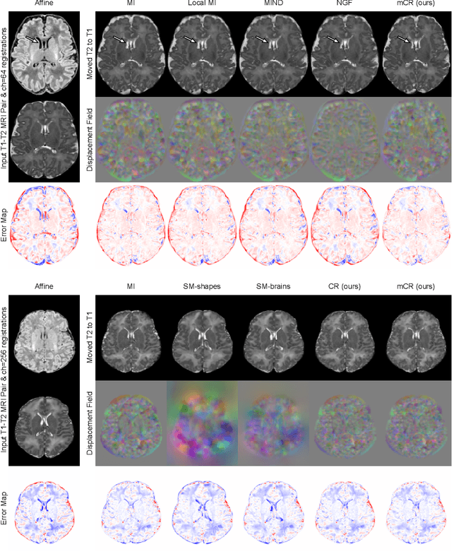 Figure 3 for ContraReg: Contrastive Learning of Multi-modality Unsupervised Deformable Image Registration