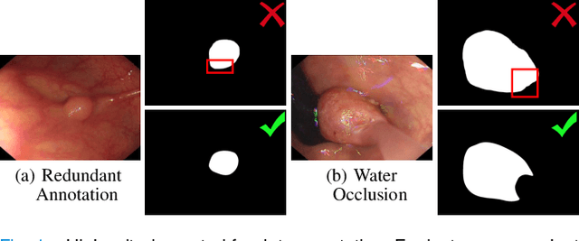 Figure 1 for Video Polyp Segmentation: A Deep Learning Perspective