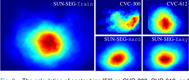 Figure 3 for Video Polyp Segmentation: A Deep Learning Perspective