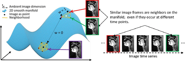 Figure 3 for Rapid dynamic speech imaging at 3 Tesla using combination of a custom vocal tract coil, variable density spirals and manifold regularization
