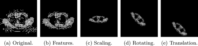 Figure 1 for CAIPI in Practice: Towards Explainable Interactive Medical Image Classification