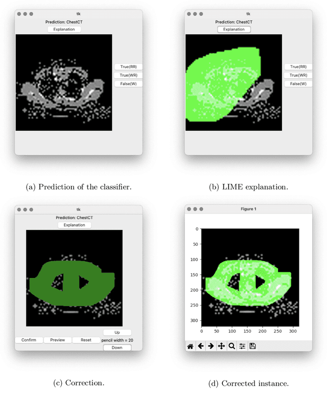 Figure 3 for CAIPI in Practice: Towards Explainable Interactive Medical Image Classification