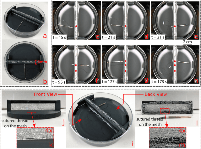 Figure 4 for Overcoming the Force Limitations of Magnetic Robotic Surgery: Impact-based Tetherless Suturing