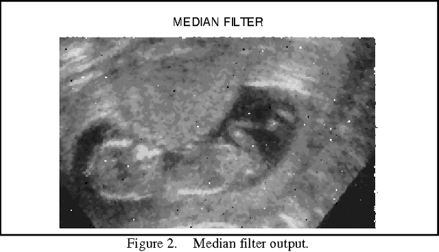 Figure 2 for Investigation and Assessment of Disorder of Ultrasound B-mode Images