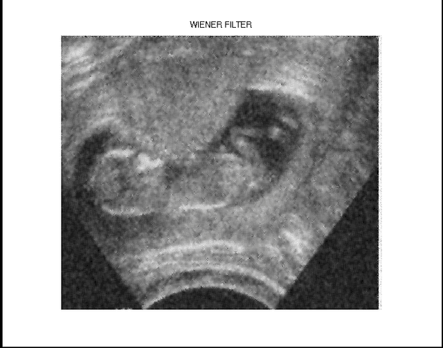 Figure 4 for Investigation and Assessment of Disorder of Ultrasound B-mode Images