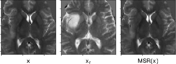 Figure 1 for Non Parametric Data Augmentations Improve Deep-Learning based Brain Tumor Segmentation