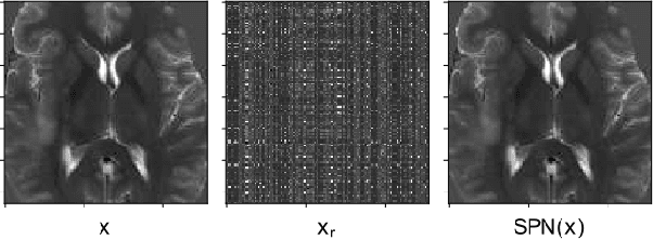 Figure 2 for Non Parametric Data Augmentations Improve Deep-Learning based Brain Tumor Segmentation