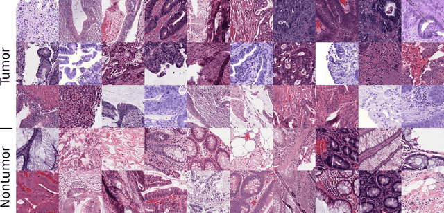 Figure 2 for FedDropoutAvg: Generalizable federated learning for histopathology image classification