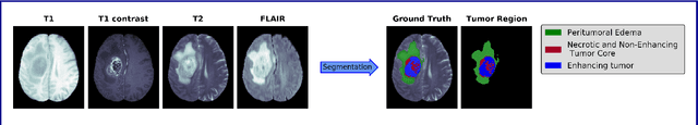 Figure 1 for Deep and Statistical Learning in Biomedical Imaging: State of the Art in 3D MRI Brain Tumor Segmentation