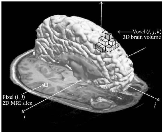 Figure 2 for Deep and Statistical Learning in Biomedical Imaging: State of the Art in 3D MRI Brain Tumor Segmentation