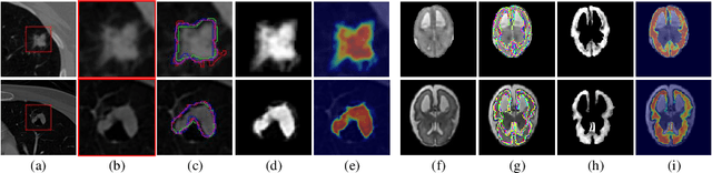 Figure 1 for Medical Matting: A New Perspective on Medical Segmentation with Uncertainty