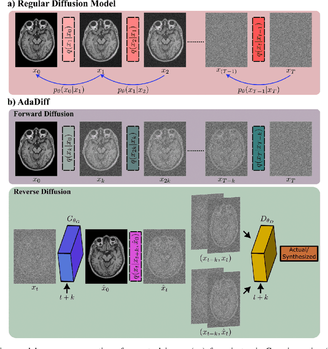 Figure 1 for Adaptive Diffusion Priors for Accelerated MRI Reconstruction