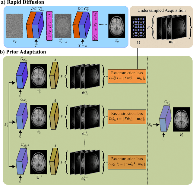 Figure 2 for Adaptive Diffusion Priors for Accelerated MRI Reconstruction