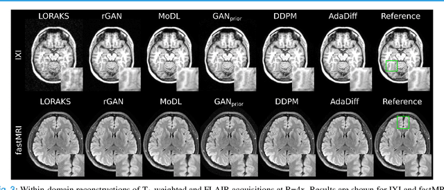 Figure 3 for Adaptive Diffusion Priors for Accelerated MRI Reconstruction