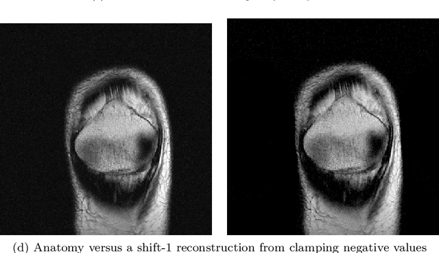 Figure 1 for Offset Masking Improves Deep Learning based Accelerated MRI Reconstructions