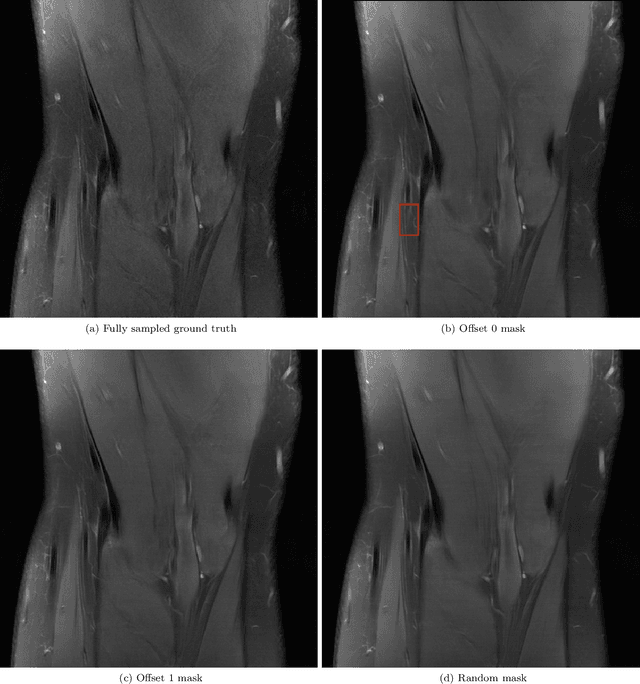 Figure 3 for Offset Masking Improves Deep Learning based Accelerated MRI Reconstructions