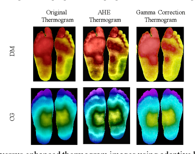 Figure 4 for A Machine Learning Model for Early Detection of Diabetic Foot using Thermogram Images