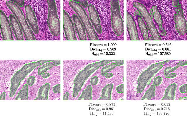 Figure 4 for Gland Segmentation in Colon Histology Images: The GlaS Challenge Contest