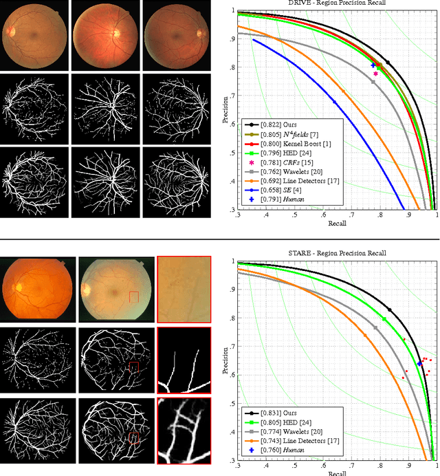 Figure 2 for Deep Retinal Image Understanding