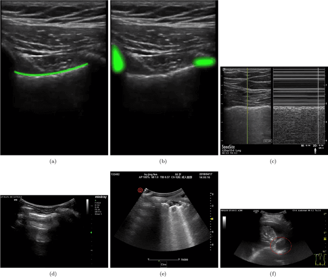 Figure 1 for Current Advances in Computational Lung Ultrasound Imaging: A Review