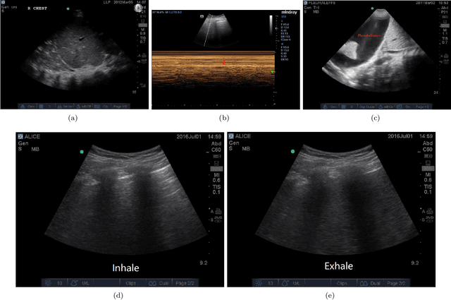 Figure 2 for Current Advances in Computational Lung Ultrasound Imaging: A Review